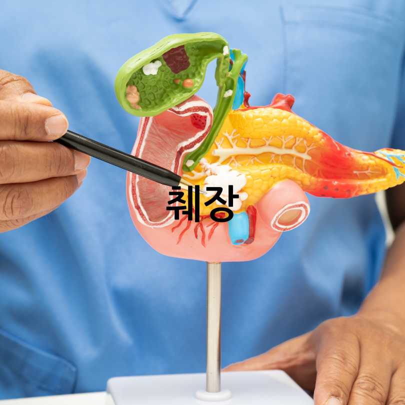 췌장암 초기증상