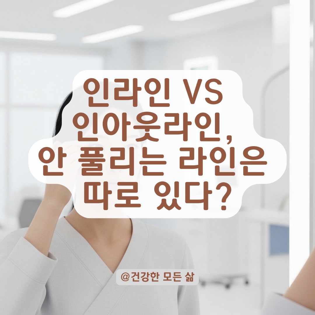인라인 vs 인아웃라인 매몰법, 디자인이 유지력을 결정한다? 팩트 체크!
