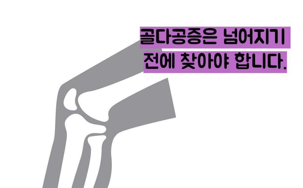 골다공증 수치
