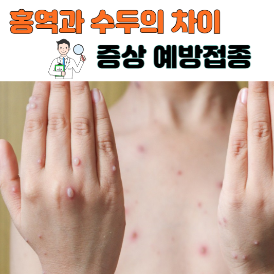 홍역 수두 차이 증상 예방접종