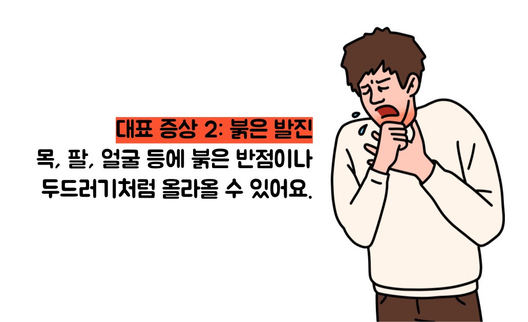 햇빛 알레르기 증상