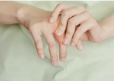 손가락 관절염 2