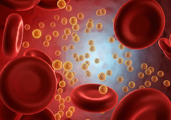 혈당스파이크 증상