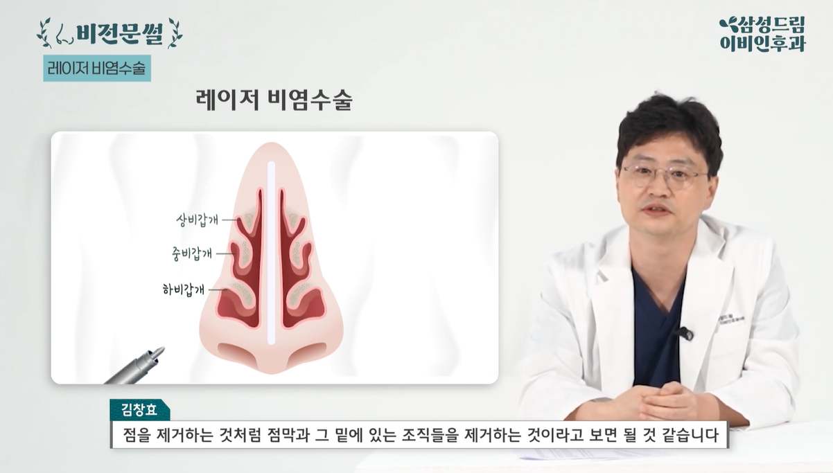 하비갑개 레이저 수술