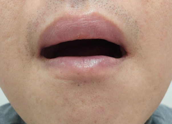 입을-살짝-벌리고있는-모습