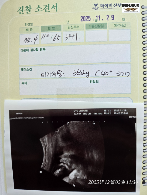 출산 2일전 초음파 검사한 모습을 아기수첩에 부착한 이미지