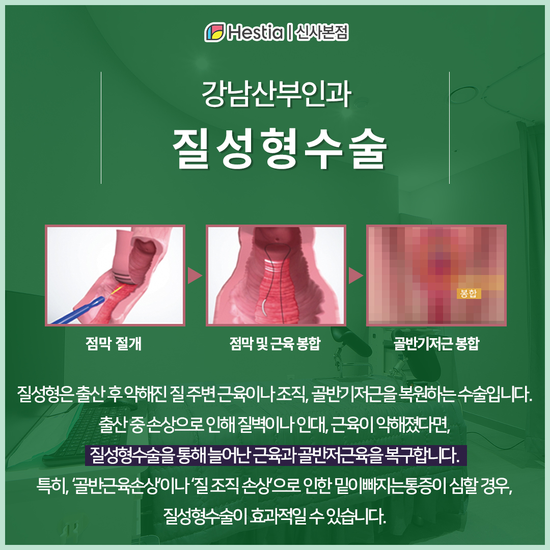 강남산부인과 어떤 치료가 있을까? - 질성형수술