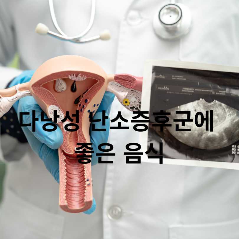 다낭성 난소증후군 증상과 좋은 음식 총정리