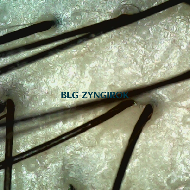 탈모 극복 프로젝트 - 정수리 두피 모습이다.