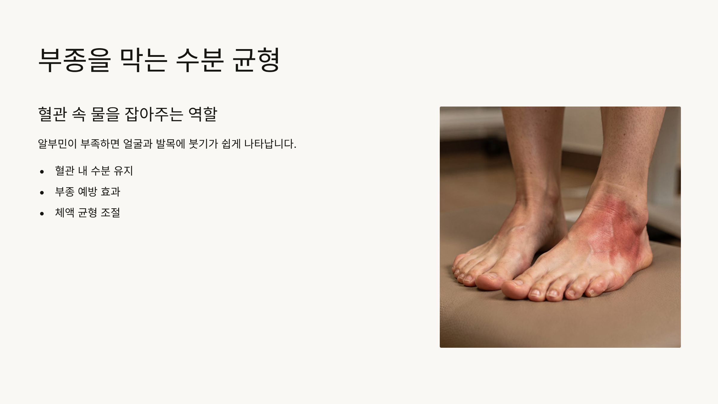 알부민의 효능 부종을 막는 수분 균형