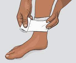 연쇄상구균 독성쇼크증후군 예방하기