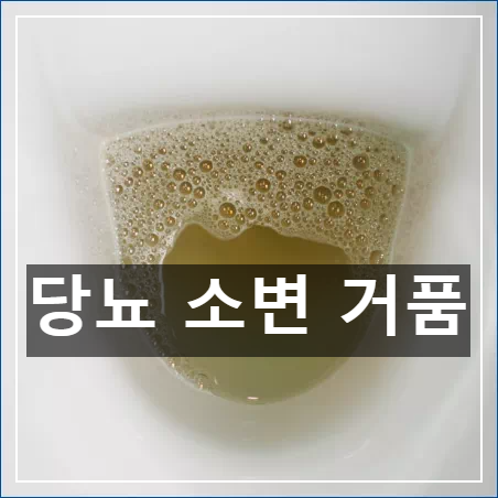 당뇨 소변 거품