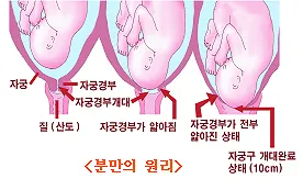 출산 후 자궁수축 기간_4