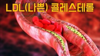 LDL 콜레스테롤이란?