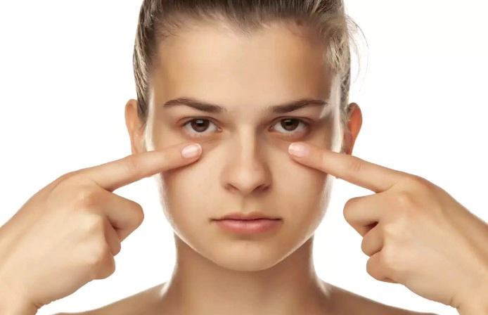 다크 서클 없애는법 9가지