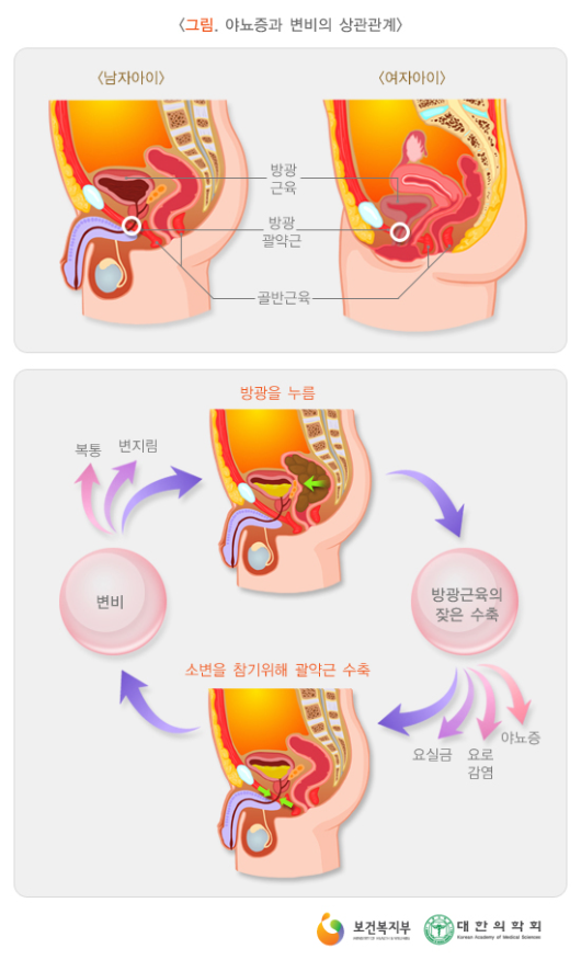 소아야뇨증