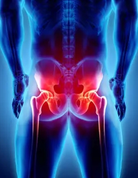 사타구니 통증 원인