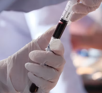 갑상선 기능 저하증 완치하는 법 진단 기준