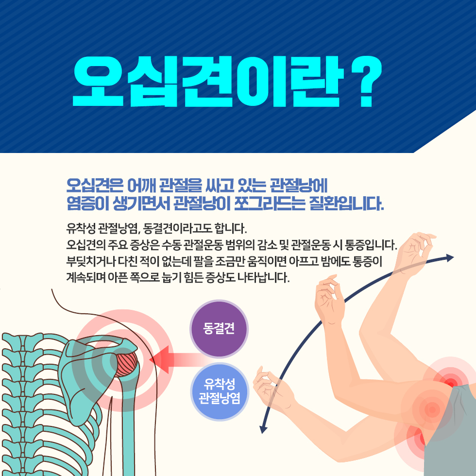 오십견 증상