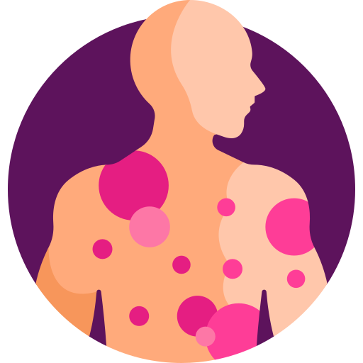 피부발진 종류 피부발진 원인 피부 붉은발진