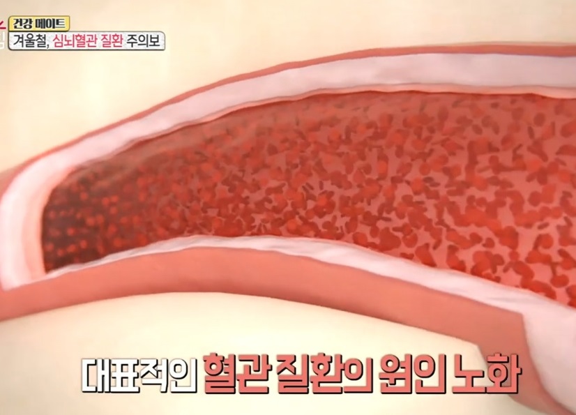 오성진-교수-심장내과