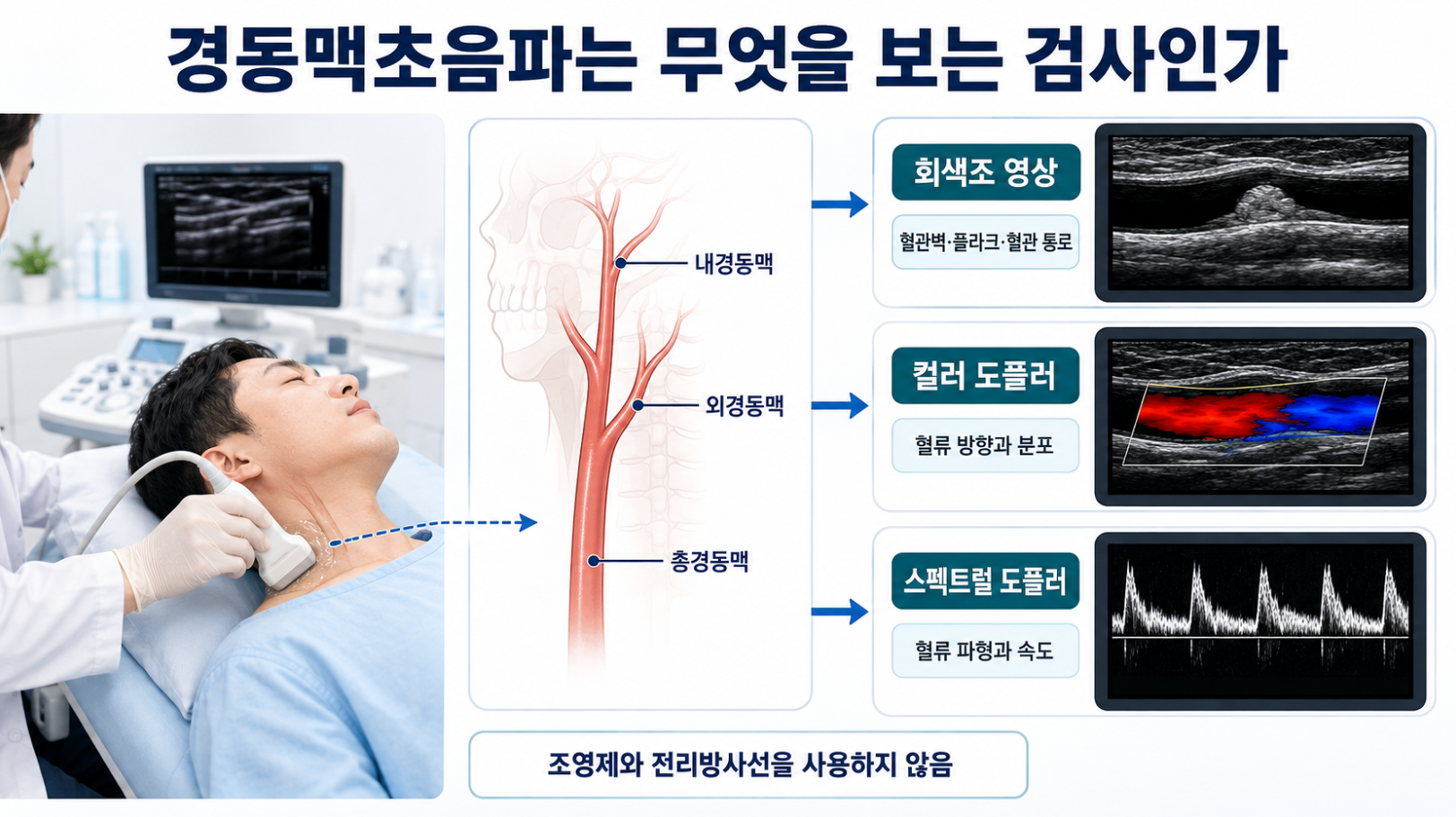 경동맥초음파 검사 장면과 회색조 영상 컬러 도플러 스펙트럴 도플러 비교
