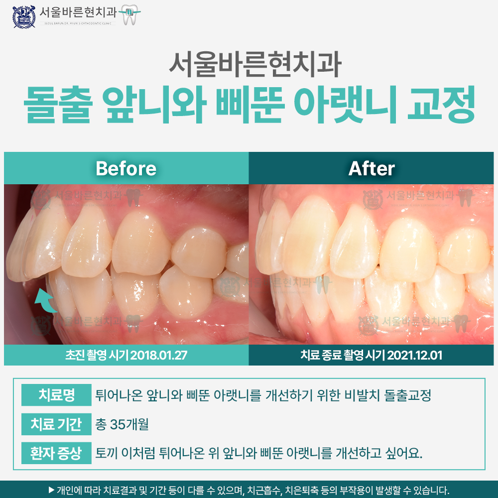 해운대교정치과