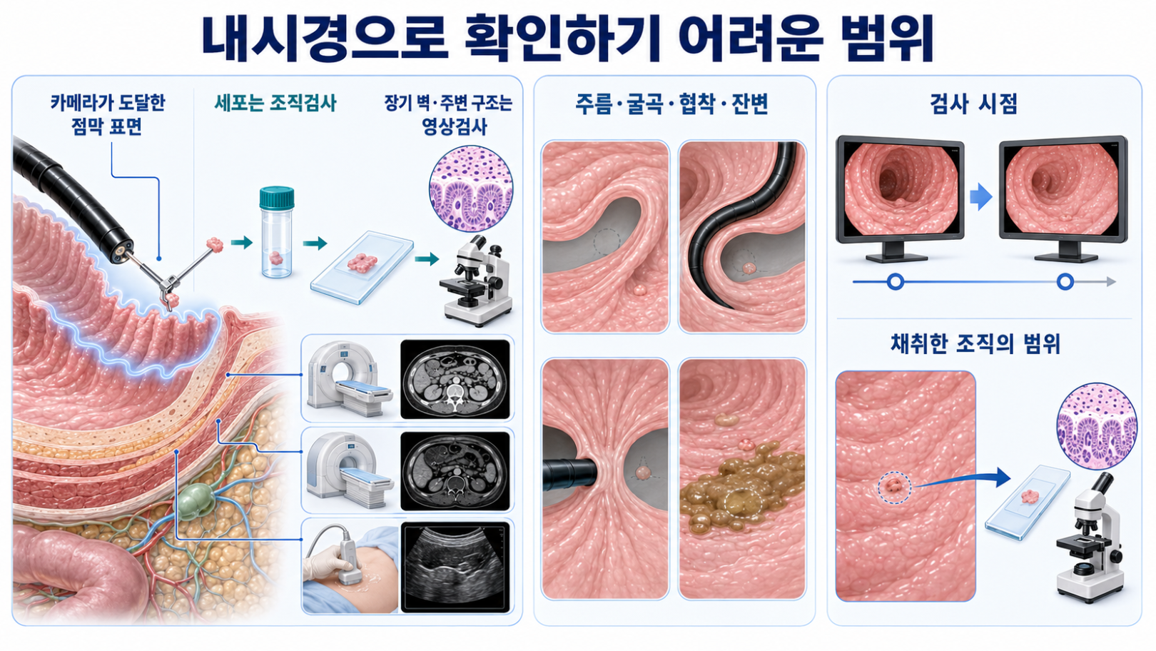 내시경으로 보기 어려운 장기 벽 바깥 구조와 가려진 병변&middot;검사 시점&middot;조직 채취 범위