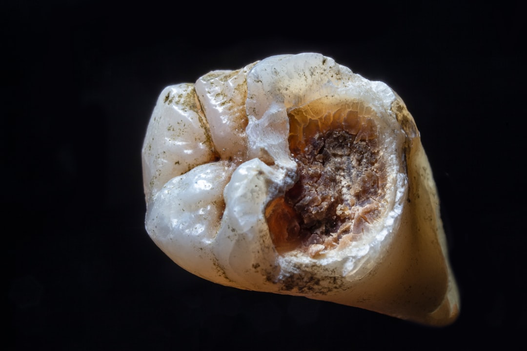 Dental implant.