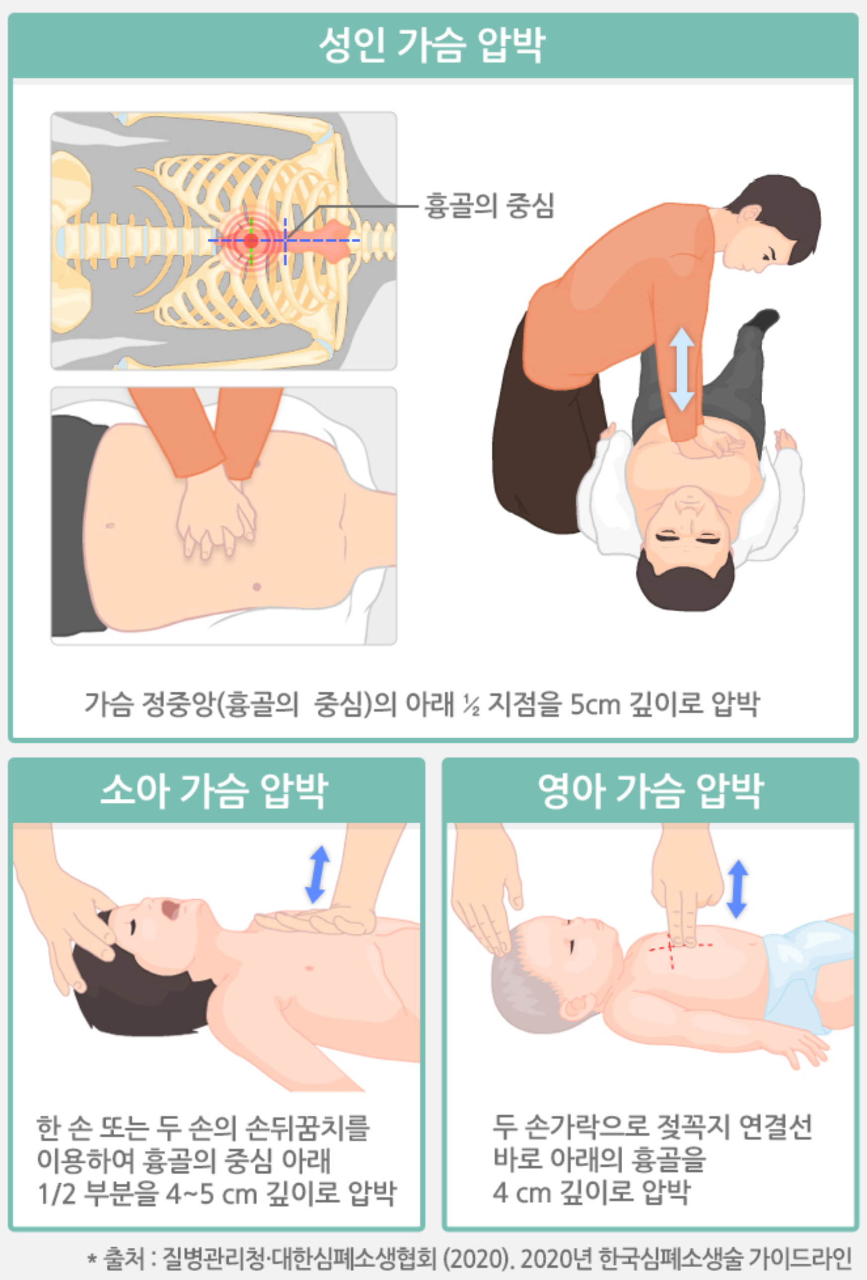 CPR시 압박부위