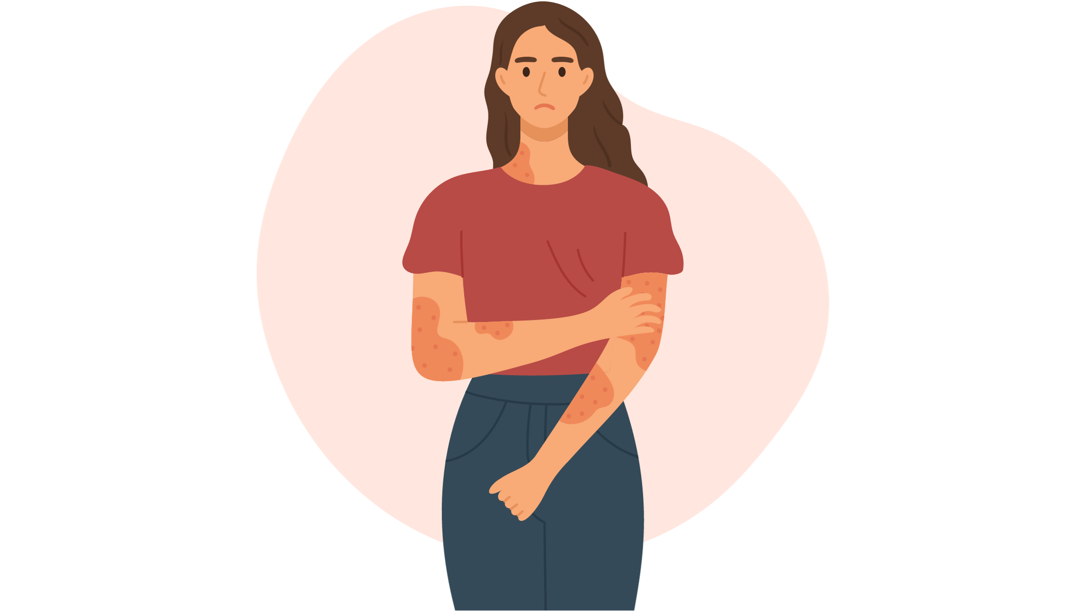 팔에 대상 포진 증상이 있는 여성 일러스트