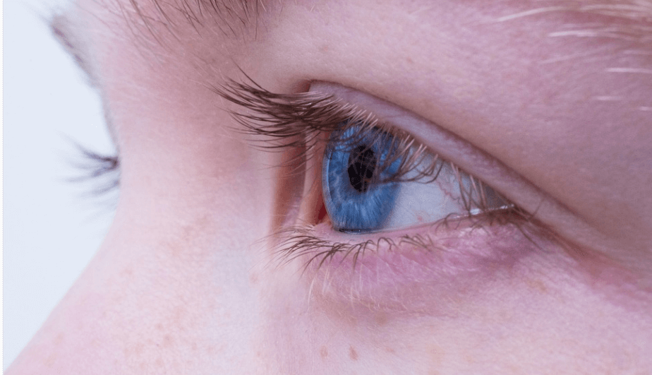 눈이 시리고 아픈 이유 - 3