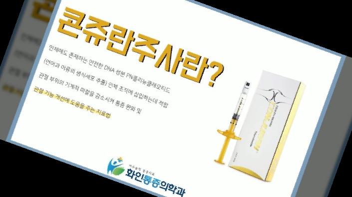 콘쥬란 주사 가격