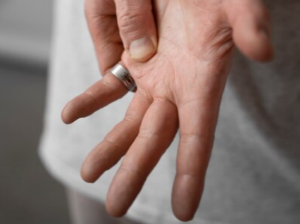 손가락 관절염 증상