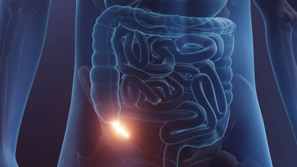 맹장 터지는 이유와 맹장염과 어떤 관계를 가지고 있는지도 알아봤습니다. 왜 맹장염이 파열로 이어질 수 있는 지와 맹장 벽이 왜 염증으로 약해지는지도 함께 읽어 보시기 바랍니다.