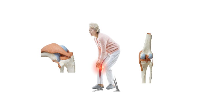 관절통증 이미지
