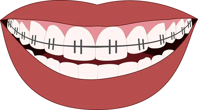 치아교정