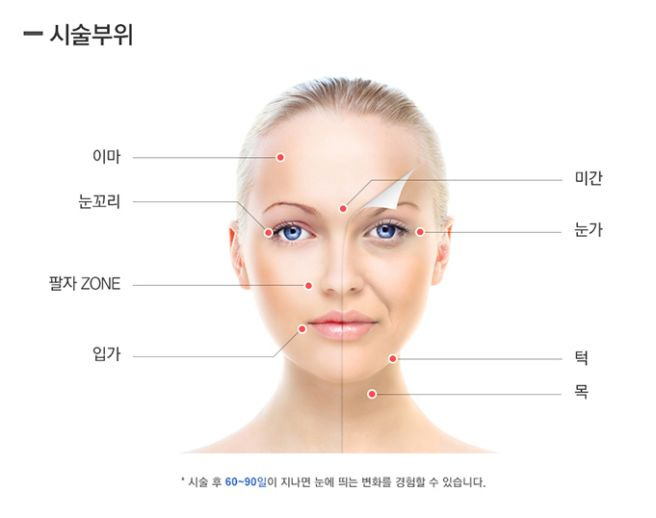 울쎄라 인모드 써마지 슈링크 차이 ❘ 리프팅 시술 어떤 피부에 맞을까?