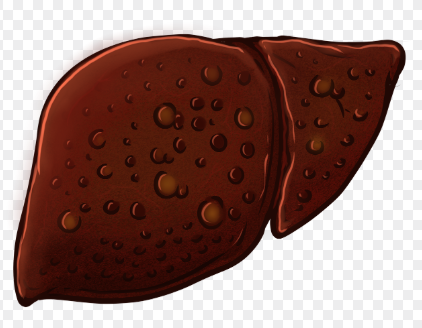 젊을 때부터 관리해야 할 간 건강: 술이 아니어도 망가진다