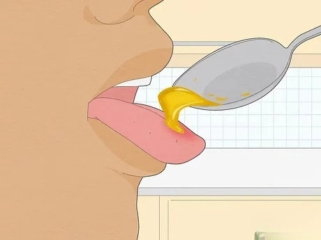 혓바늘이 돋는 이유 원인과 혓바늘 없애는 방법 꿀 치료법 자주돋는 현상