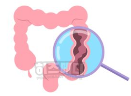 분변검사 방법