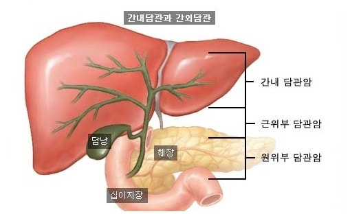 담도암이란? 정의와 종류