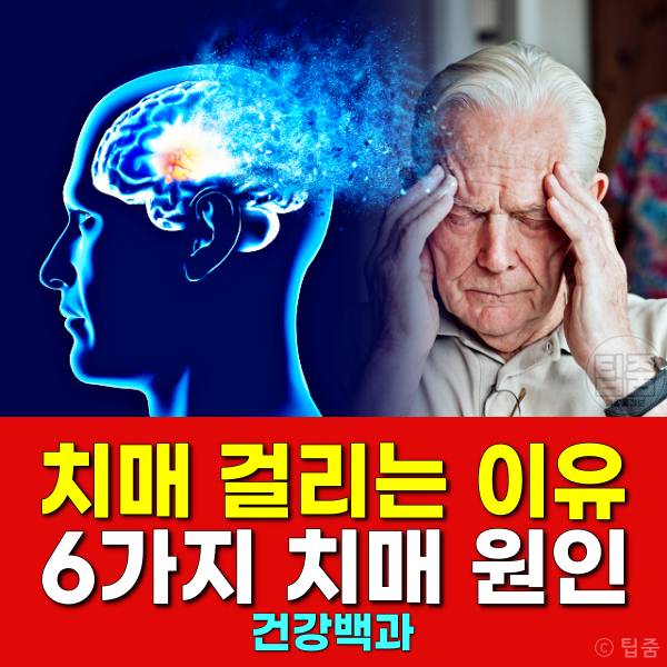 치매 걸리는 이유 습관 치매 생기는 이유 치매원인