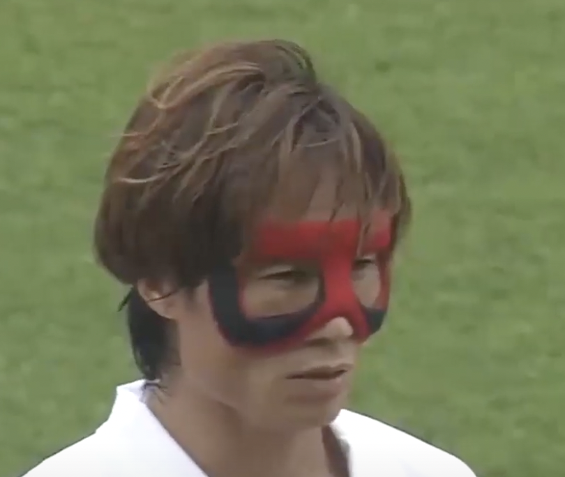 손흥민 수술 후 월드컵 출전