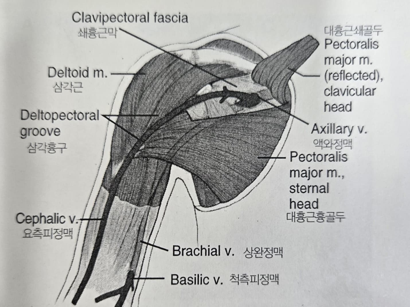 견갑대의 운동 손상 증후군 - 흉상완 근육