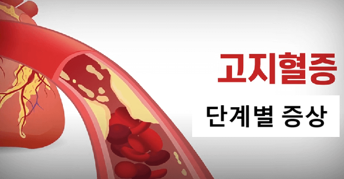 고지혈증증상