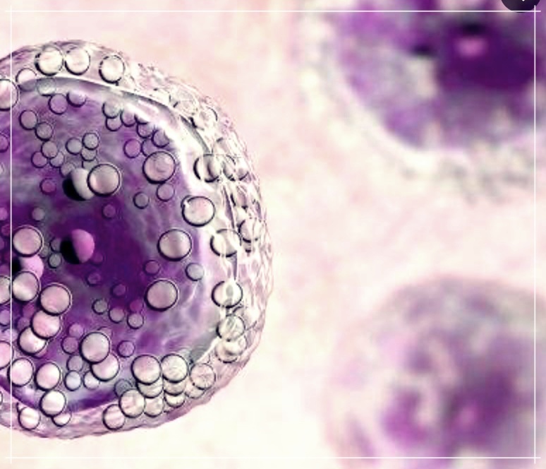 호지킨림프종과 비호지킨림프종: 이해, 진단, 그리고 치료