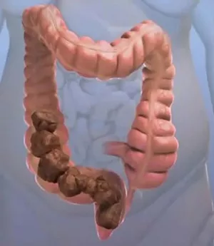 대장기관