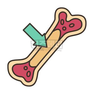 백혈구 수치가 낮은 이유