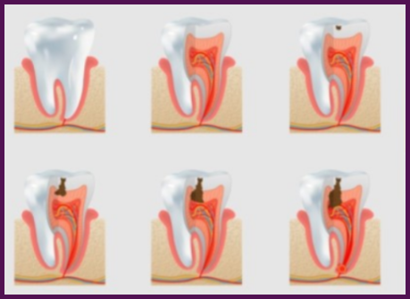 정릉동치과 추천 29년 경력 대표원장 과잉진료 없는 곳 임플란트 전 자연치아 살리기 치료 잘하는 치과 선택 기준